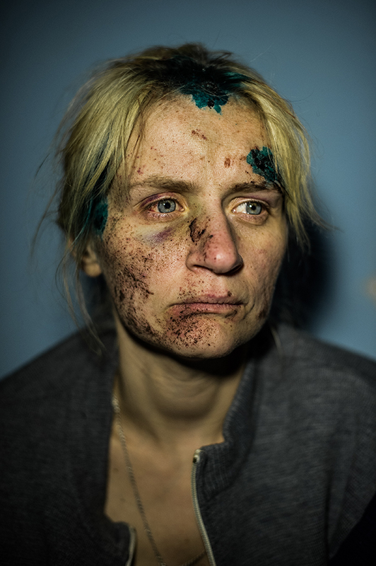 Larysa, a 30-year old citizen of Mykolayivka, a town near Sloviansk, Donetsk region, Ukraine, sits in the hospital after her home was destroyed by mortar shelling, July 5, 2014. Ukrainian army recaptured Sloviansk and nearby towns from pro-Russian rebels on July 5, 2014, after more then two months of artillery fire from both sides. (Image: "Shelling survivor" by Alexey Furman, 2015 Picture of the Year First Place Winner in Portrait Category, POYI.org)