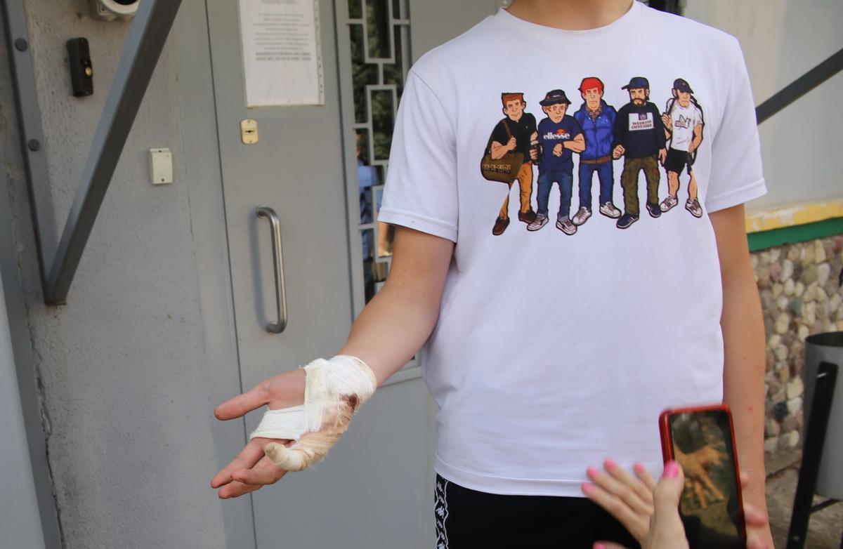 Belarusian police detain and beat teenagers, injure 5 year old
