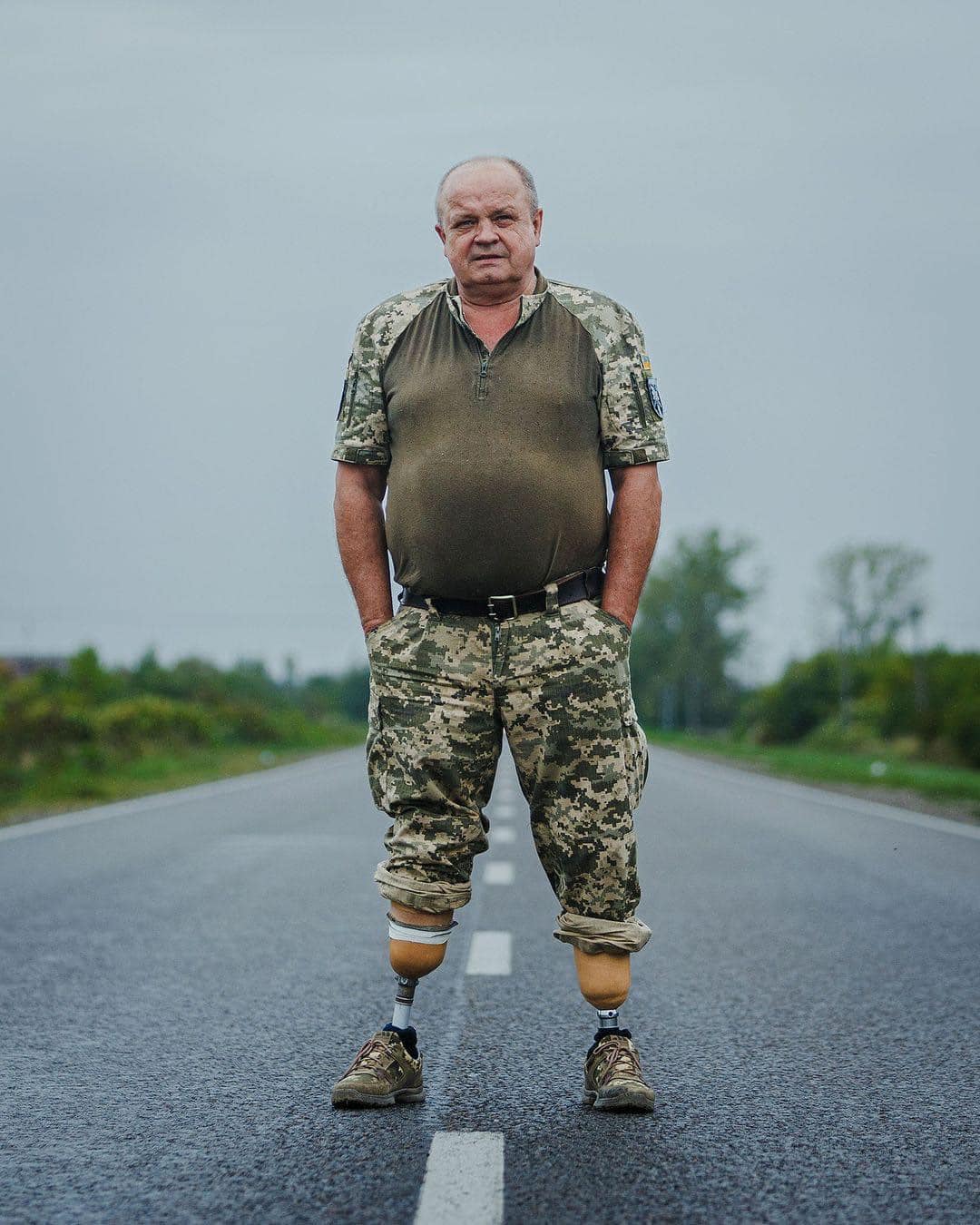 Ukrainian with prosthetics of both legs defends his homeland